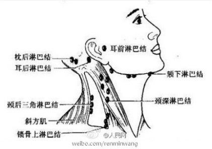 李开复罹患淋巴癌 盘点科技圈人士易患的癌症