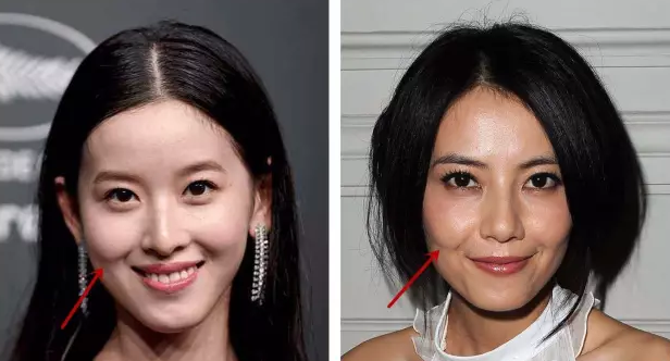 奶茶妹妹才24岁,竟然就出现了笑肌断层!
