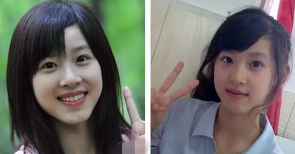 奶茶妹妹才24岁,竟然就出现了笑肌断层!