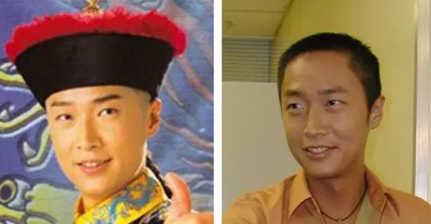 奶茶妹妹才24岁,竟然就出现了笑肌断层!