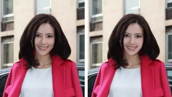 奶茶妹妹才24岁,竟然就出现了笑肌断层!